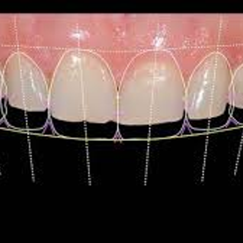 SMILE DESIGN