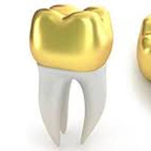 PFM CROWN IN 3D PROCEDURE