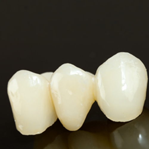 AMERICAN ZIRCONIUM CROWN